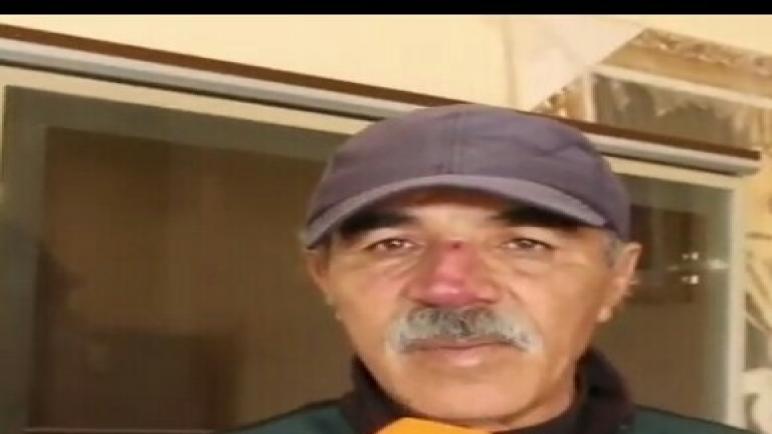 لحصيري العضو بجماعة احرارة يجري عملية جراحية بمراكش